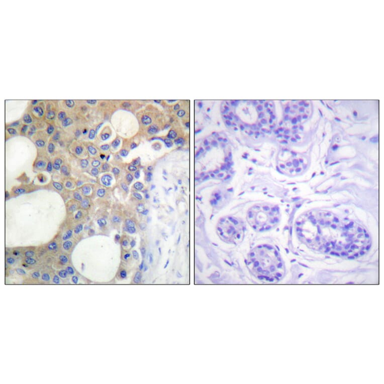 Immunohistochemistry - Anti-CD227 Antibody (B1193) - Antibodies.com