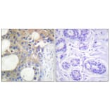 Immunohistochemistry - Anti-CD227 Antibody (B1193) - Antibodies.com