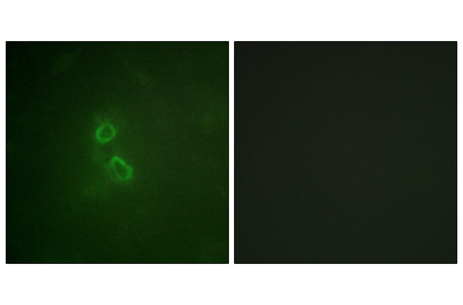 Immunofluorescence - Anti-CD227 Antibody (B1193) - Antibodies.com