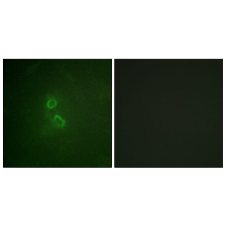 Immunofluorescence - Anti-CD227 Antibody (B1193) - Antibodies.com