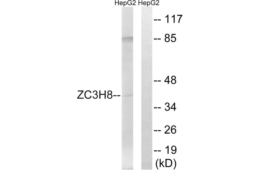 Western Blot - Anti-ZC3H8 Antibody (C19576) - Antibodies.com