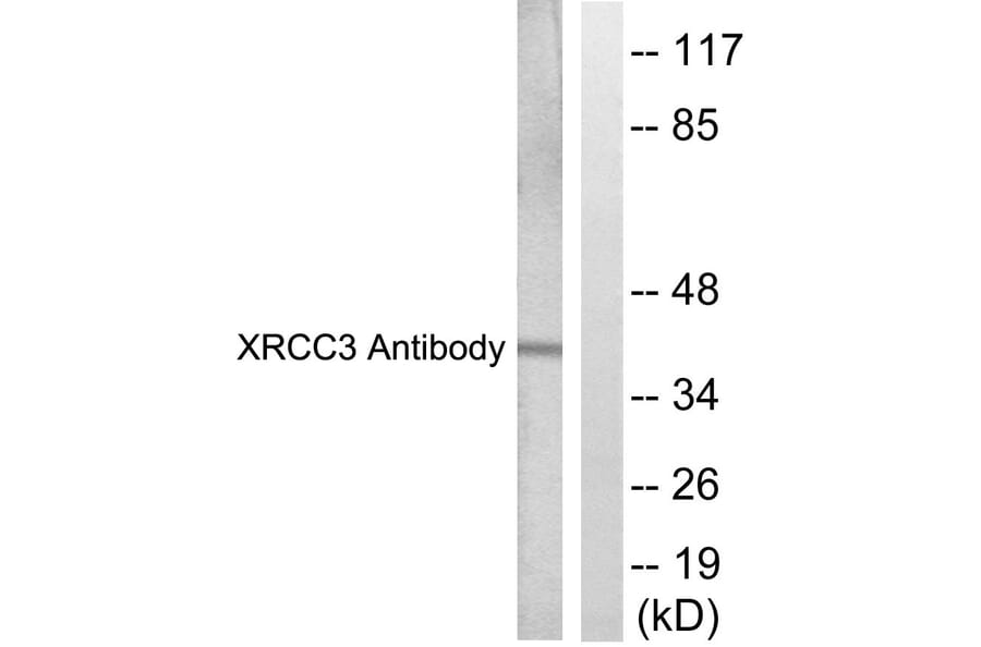 Western Blot - Anti-XRCC3 Antibody (C0397) - Antibodies.com