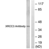 Western Blot - Anti-XRCC3 Antibody (C0397) - Antibodies.com