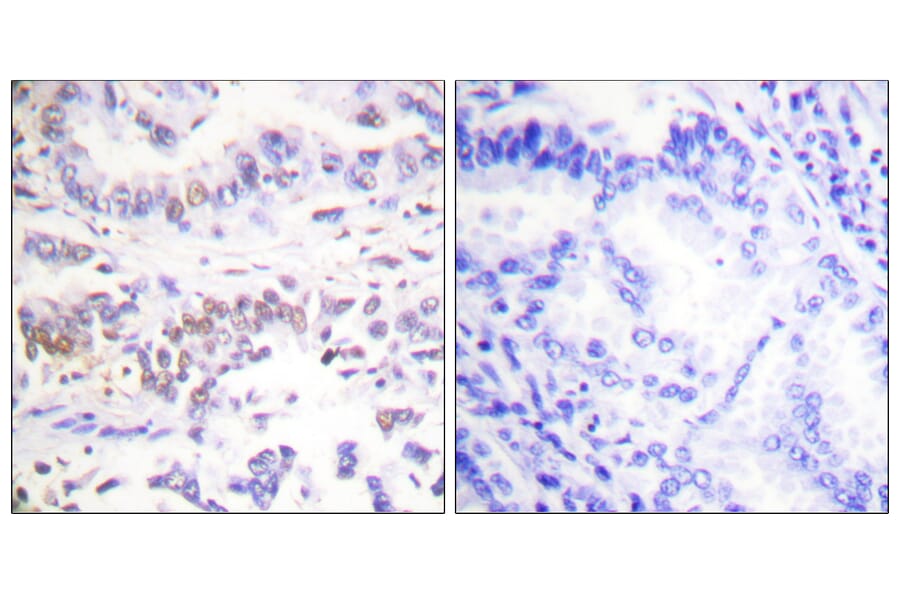 Immunohistochemistry - Anti-XRCC3 Antibody (C0397) - Antibodies.com