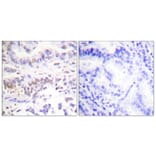 Immunohistochemistry - Anti-XRCC3 Antibody (C0397) - Antibodies.com