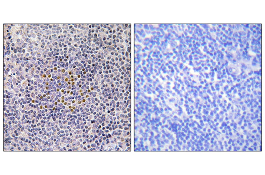 Immunohistochemistry - Anti-XRCC3 Antibody (C13130) - Antibodies.com