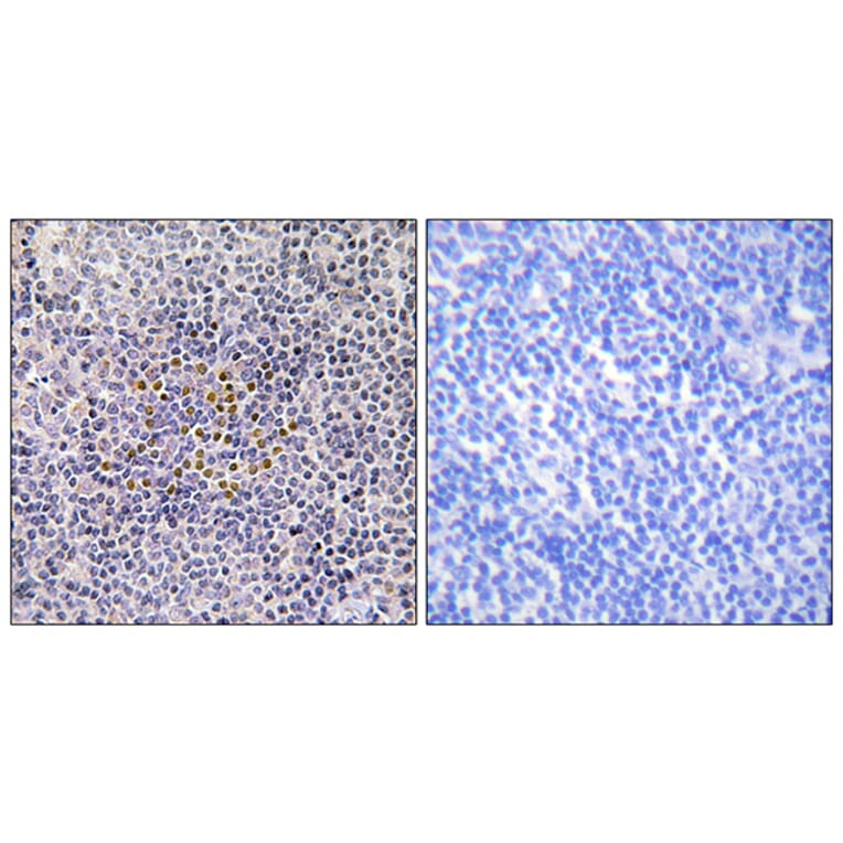 Immunohistochemistry - Anti-XRCC3 Antibody (C13130) - Antibodies.com