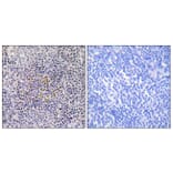 Immunohistochemistry - Anti-XRCC3 Antibody (C13130) - Antibodies.com