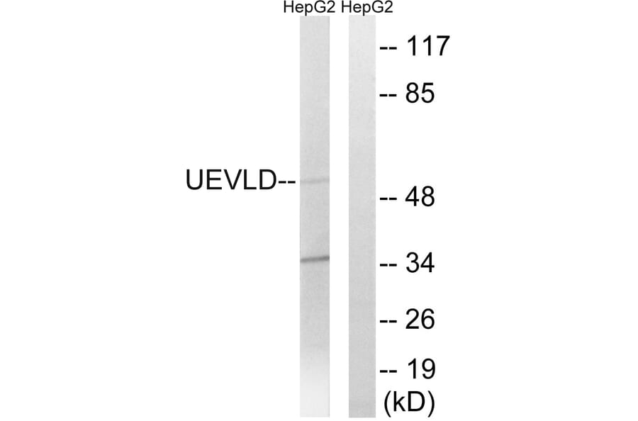 Western Blot - Anti-UEVLD Antibody (C19451) - Antibodies.com