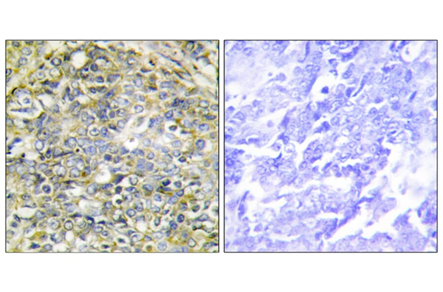 Immunohistochemistry - Anti-UBXD5 Antibody (C11186) - Antibodies.com