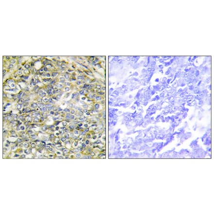 Immunohistochemistry - Anti-UBXD5 Antibody (C11186) - Antibodies.com