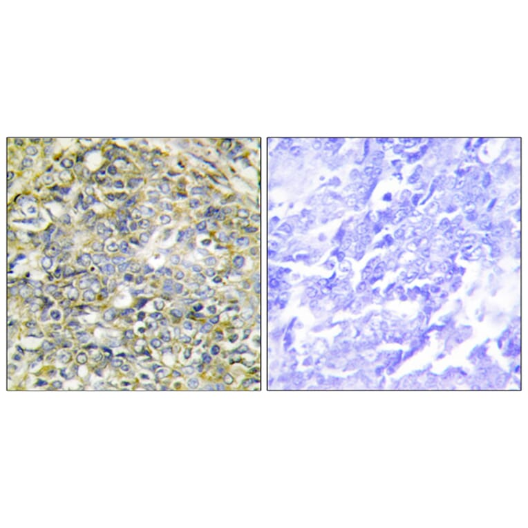Immunohistochemistry - Anti-UBXD5 Antibody (C11186) - Antibodies.com