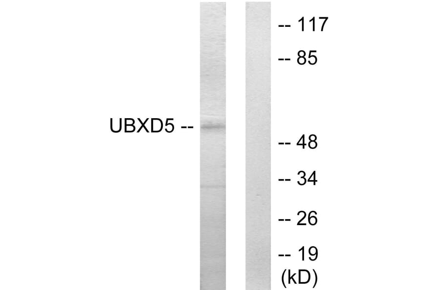 Western Blot - Anti-UBXD5 Antibody (C11186) - Antibodies.com
