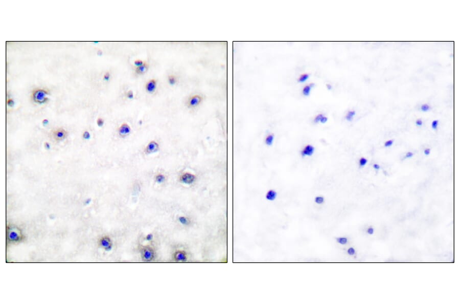 Immunohistochemistry - Anti-Trk A Antibody (B0034) - Antibodies.com
