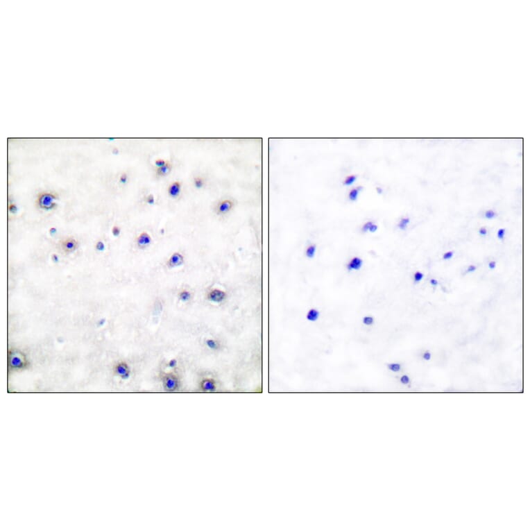 Immunohistochemistry - Anti-Trk A Antibody (B0034) - Antibodies.com