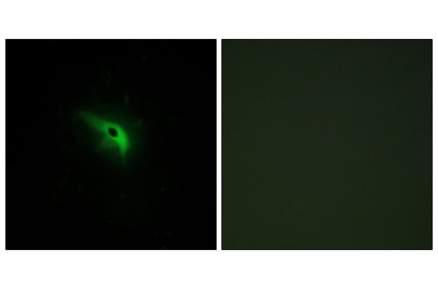Immunofluorescence - Anti-TPIP1 Antibody (C13126) - Antibodies.com