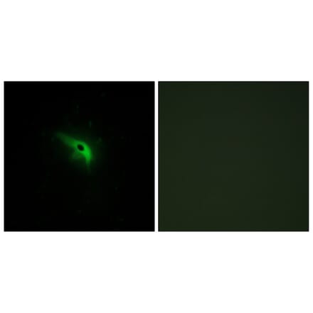 Immunofluorescence - Anti-TPIP1 Antibody (C13126) - Antibodies.com