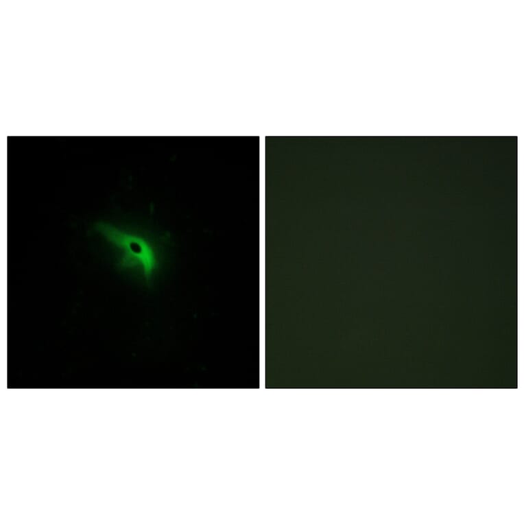 Immunofluorescence - Anti-TPIP1 Antibody (C13126) - Antibodies.com