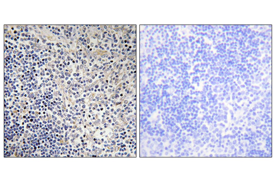 Immunohistochemistry - Anti-TPIP1 Antibody (C13126) - Antibodies.com