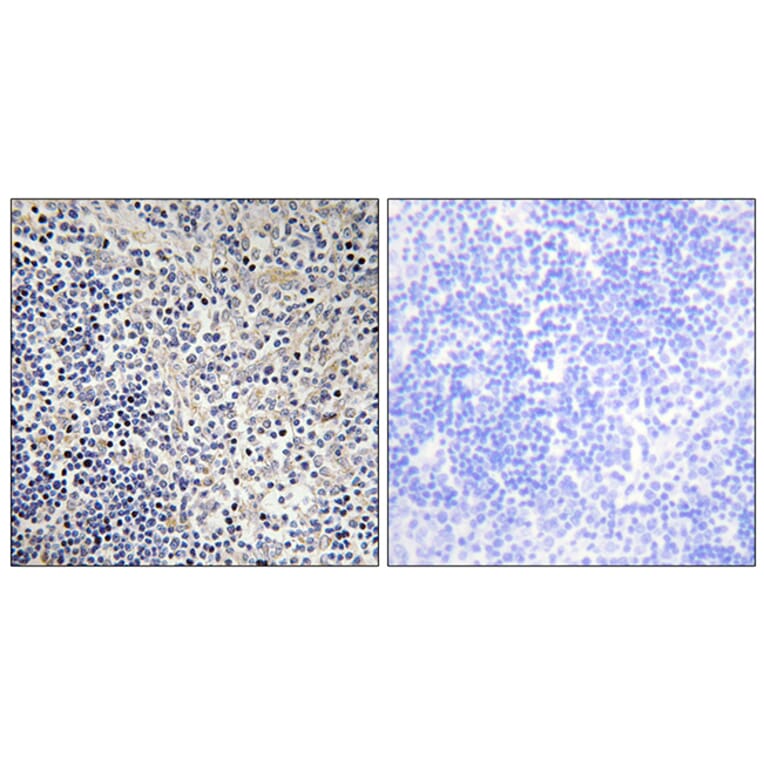 Immunohistochemistry - Anti-TPIP1 Antibody (C13126) - Antibodies.com