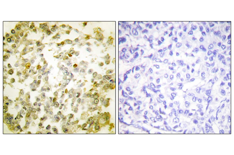 Immunohistochemistry - Anti-TOP2A Antibody (B1130) - Antibodies.com