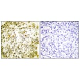 Immunohistochemistry - Anti-TOP2A Antibody (B1130) - Antibodies.com