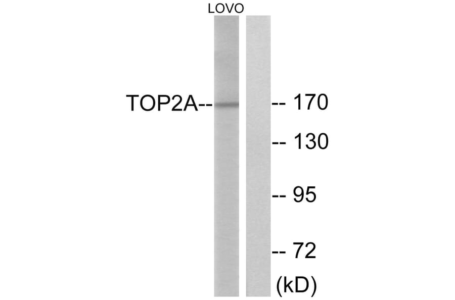Western Blot - Anti-TOP2A Antibody (B1130) - Antibodies.com