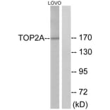 Western Blot - Anti-TOP2A Antibody (B1130) - Antibodies.com