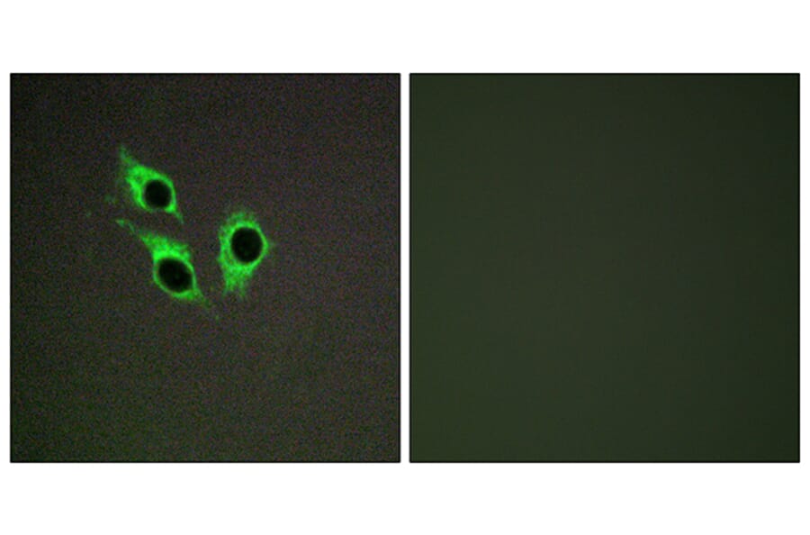 Immunofluorescence - Anti-TM16J Antibody (C10001) - Antibodies.com