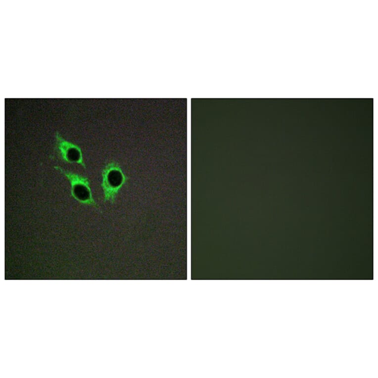 Immunofluorescence - Anti-TM16J Antibody (C10001) - Antibodies.com