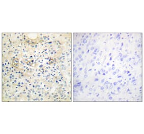 Immunohistochemistry - Anti-TM16G Antibody (C11220) - Antibodies.com