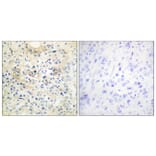 Immunohistochemistry - Anti-TM16G Antibody (C11220) - Antibodies.com