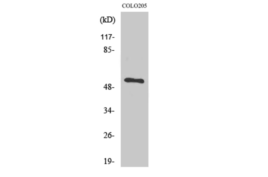 Western Blot - Anti-TIGD3 Antibody (C19118) - Antibodies.com