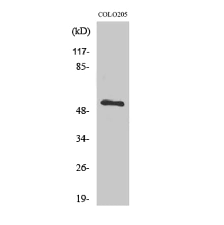 Western Blot - Anti-TIGD3 Antibody (C19118) - Antibodies.com