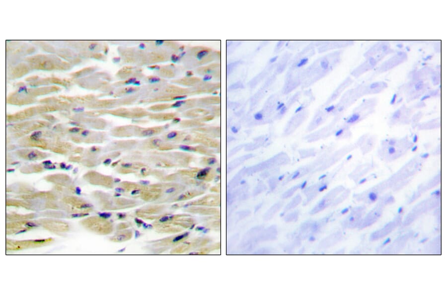 Immunohistochemistry - Anti-TENS3 Antibody (C11208) - Antibodies.com