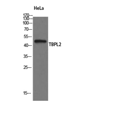 Western Blot - Anti-TBPL2 Antibody (C20597) - Antibodies.com