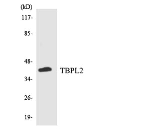 Western Blot - Anti-TBPL2 Antibody (R12-3601) - Antibodies.com