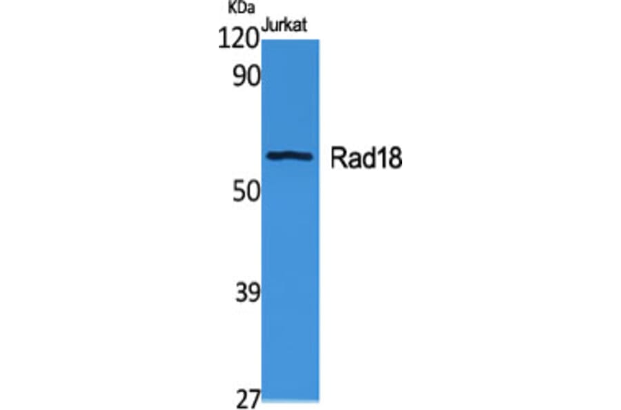 Western Blot - Anti-RAD18 Antibody (C15564) - Antibodies.com