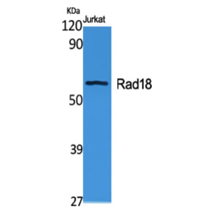Western Blot - Anti-RAD18 Antibody (C15564) - Antibodies.com