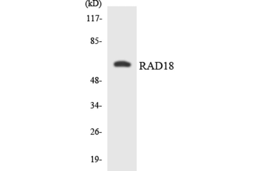 Western Blot - Anti-RAD18 Antibody (R12-3396) - Antibodies.com