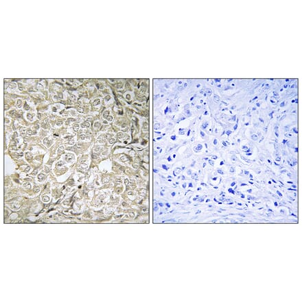 Immunohistochemistry - Anti-RAB37 Antibody (C18247) - Antibodies.com