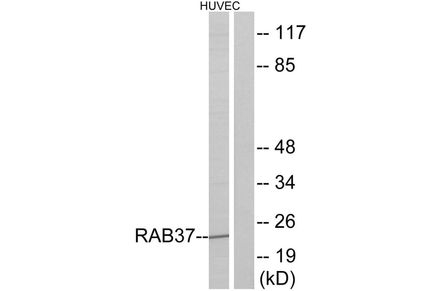 Western Blot - Anti-RAB37 Antibody (C18247) - Antibodies.com
