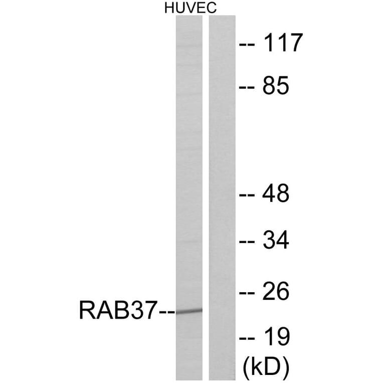 Western Blot - Anti-RAB37 Antibody (C18247) - Antibodies.com