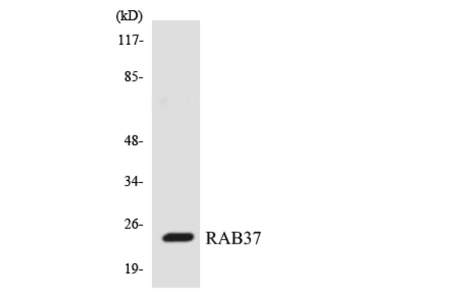Western Blot - Anti-RAB37 Antibody (R12-3391) - Antibodies.com