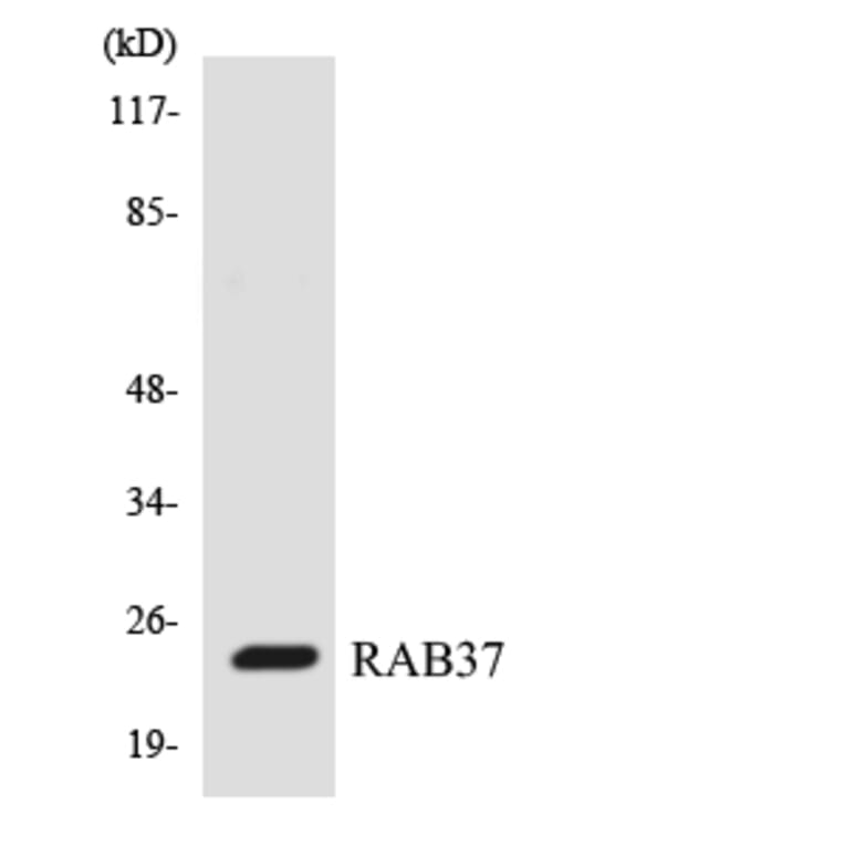 Western Blot - Anti-RAB37 Antibody (R12-3391) - Antibodies.com