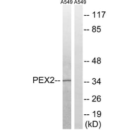 Western Blot - Anti-PXMP3 Antibody (C17646) - Antibodies.com