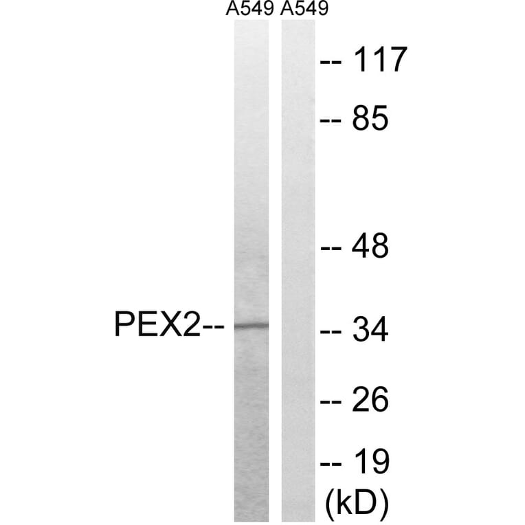 Western Blot - Anti-PXMP3 Antibody (C17646) - Antibodies.com