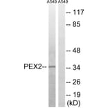 Western Blot - Anti-PXMP3 Antibody (C17646) - Antibodies.com