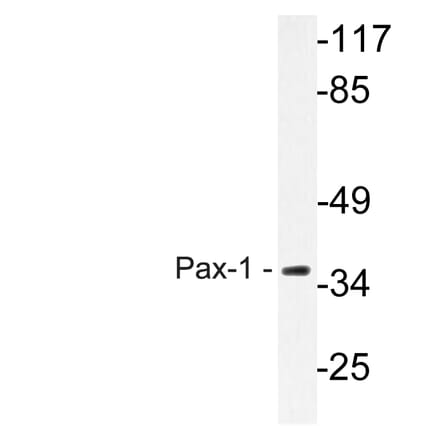 Western Blot - Anti-Pax-1 Antibody (R12-2292) - Antibodies.com