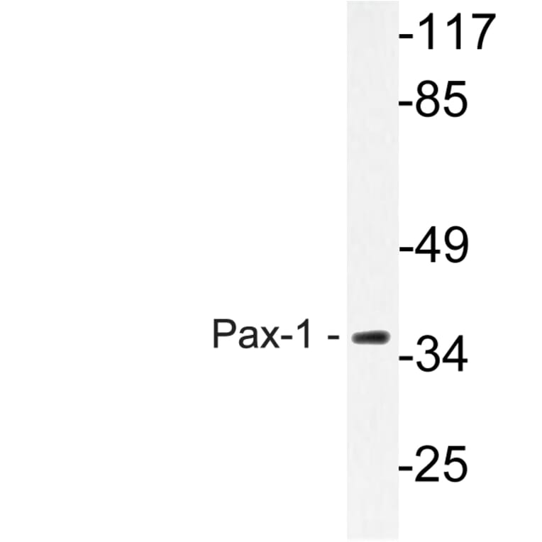 Western Blot - Anti-Pax-1 Antibody (R12-2292) - Antibodies.com